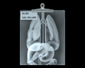Image of X-Ray of GAIL