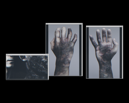 Image of Report on Raccoon City Syndrome