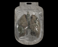 Image of Artificial Lungs